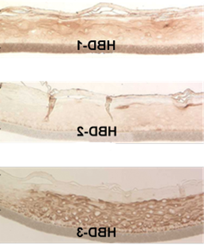Figure 3: Immuno-staining of the GIN-100 tissue for human beta defensins (HBDs).